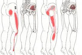 脊柱管狭窄症の原因の筋肉